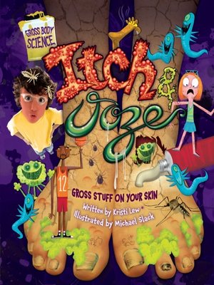 cover image of Itch & Ooze